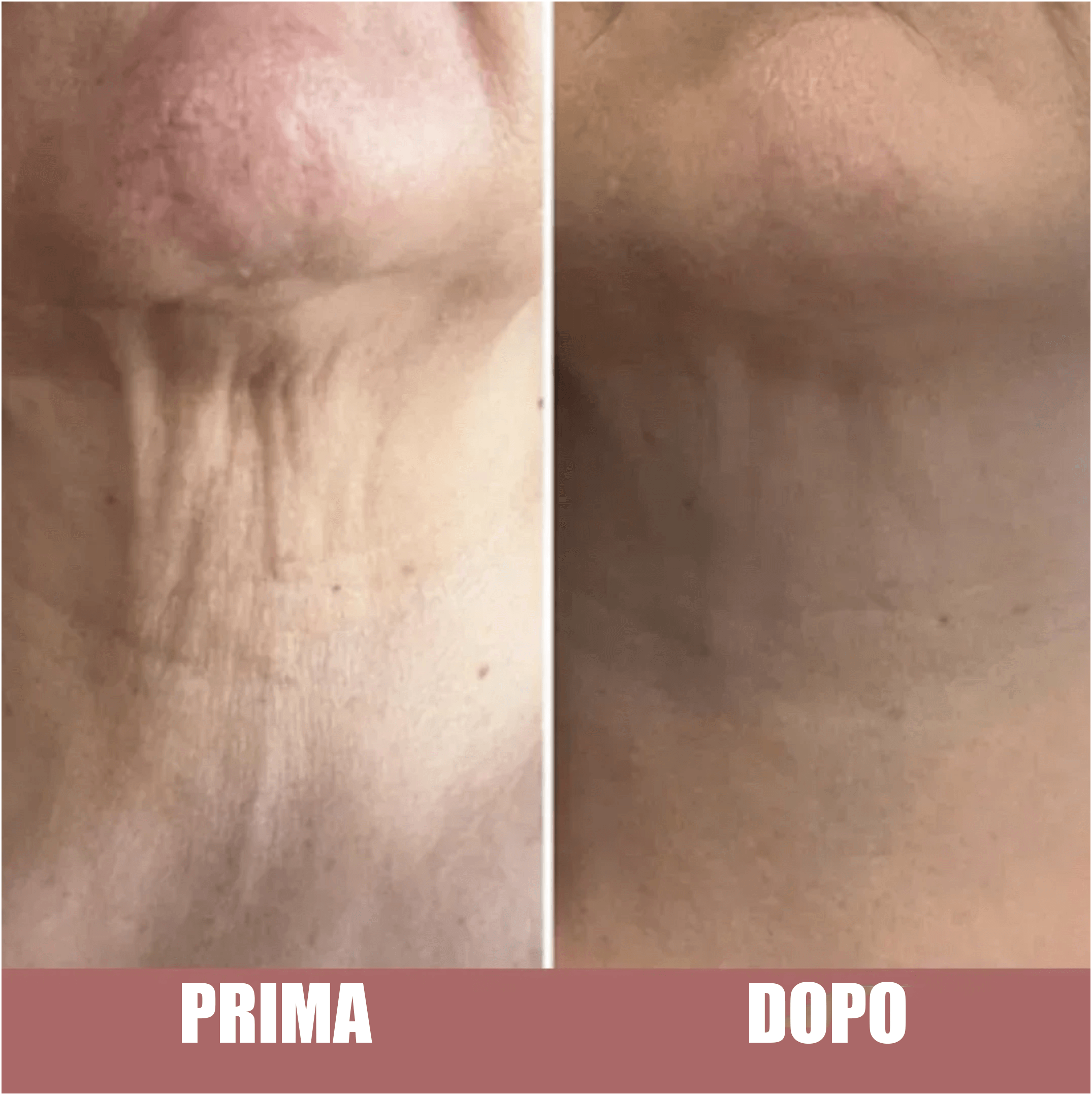 Crema Rassodante Avanzata Per Il Collo